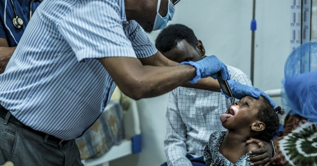 Diphtheria, a once vanquished killer of children, is resurgent