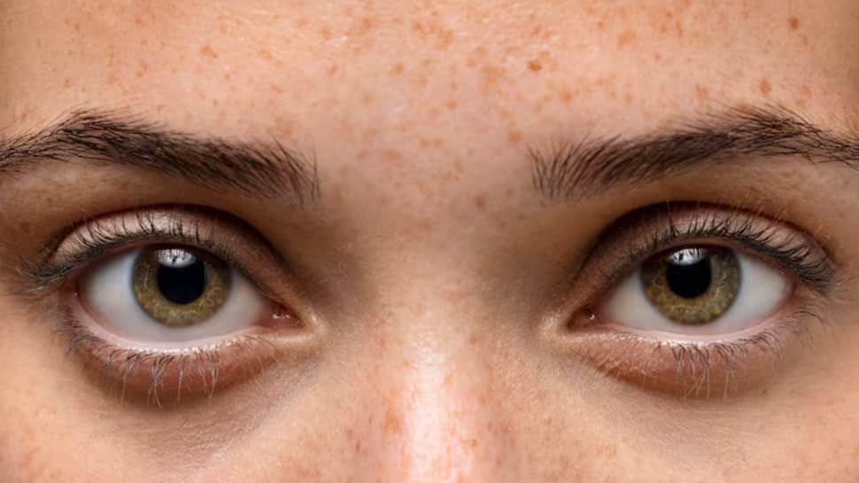 Eye Scans Could Reveal How Fast You’re Ageing and Your Heart Disease Risk, Study Finds | Health News