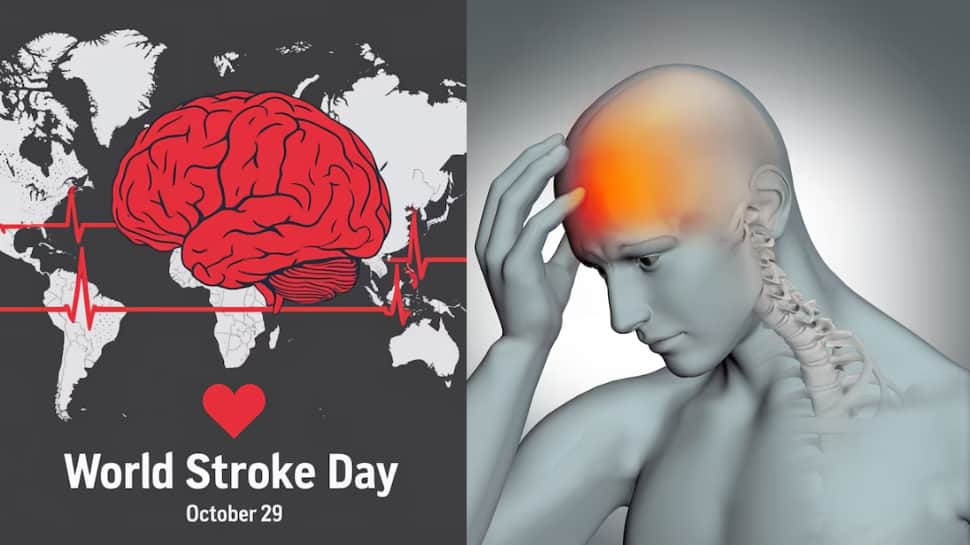 World Stroke Day 2025: Experts Reveal Early Warning Signs You Should Never Ignore | Health News
