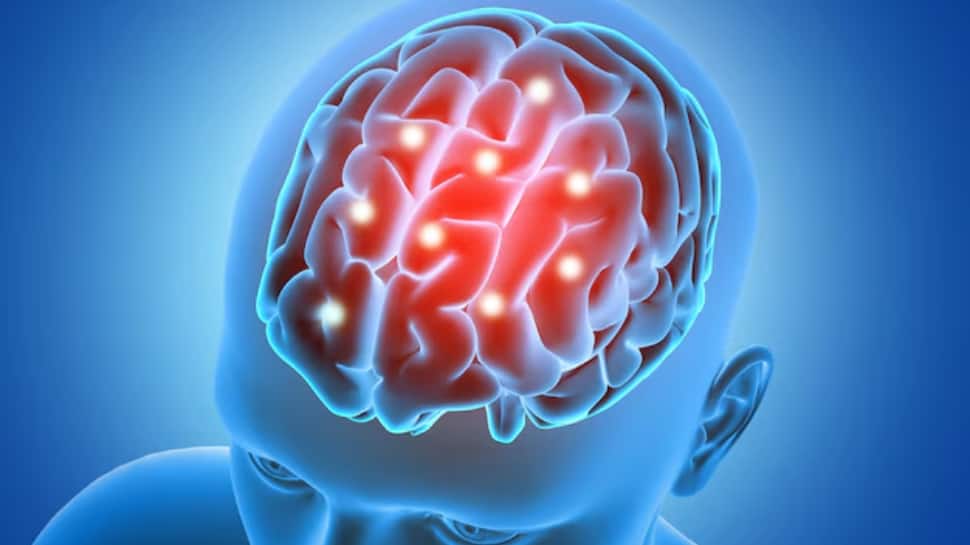 Rising Brain Stroke Cases In India: Experts Reveal How Lack Of Sleep And Stress Are Putting Even Young Adults At Risk | Health News