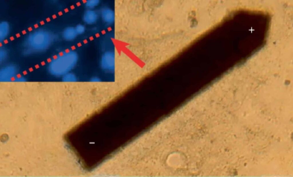 This Implant Smaller Than a Grain of Salt Can Track Brain Activity for an Entire Year!