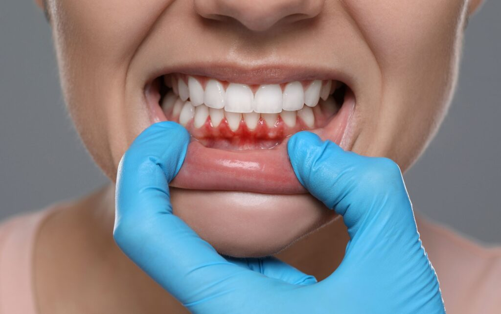 The Connection Between Periodontal Disease And Overall Health